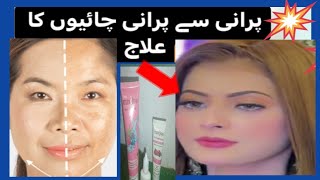 How To remove pigmentation from facepigmentation ka ilaaj ab bouhat assan [upl. by Seaman]