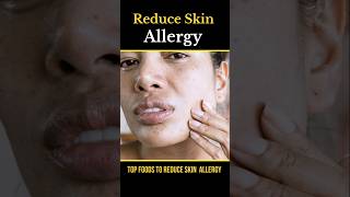 Foods reduce skin allergy  skin care skincare [upl. by Veradi]