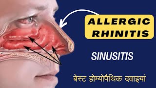 Allergic Rhinitis Sinusitis नाक व गले से डिस्चार्ज  Best Homeopathic Medicine [upl. by Enylekcaj]