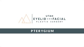 Pterygium Surgery and Pingueculum [upl. by Eedissac]