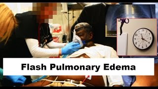 Flash Pulmonary Edema Emergency [upl. by Eberly]