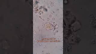 entamoeba histolytica pseudopodia locomotion through pseudopodia [upl. by Milore]