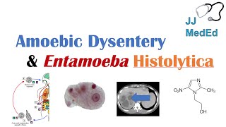 Amebiasis Amoebic Dysentery  Entamoeba histolytica Pathogenesis Signs amp Symptoms Treatment [upl. by Aubrette663]