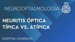 NEURITIS ÓPTICA TÍPICA VS ATÍPICA [upl. by Trebmer221]