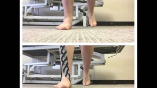 Kinesiology Rocktape to correct over pronation [upl. by Epolenep]