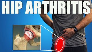 HIP OSTEOARTHRITIS BEST Exercises Stretches amp Advice for Hip amp Groin Pain Relief [upl. by Ahsiaa]