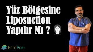 Yüz Bölgesine Liposuction Yapılır Mı amp Dr Ali Mezdeği [upl. by Verras117]