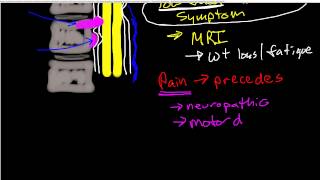 Oncologic Emergencies Spinal Cord Compression [upl. by Eeluj]