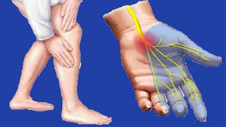 Paresthesia Causes And Symptoms [upl. by Ancell]