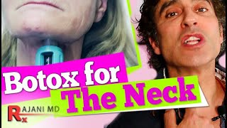 BOTOX for THE NECK  Neck Lift [upl. by Noiram]