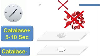 Catalase Coagulase and Oxidase Tests [upl. by Nevsa]