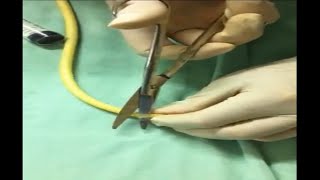 How to use a standard Foleycatheter for Bladder irrigationdrainage if unavailable 3ways catheter [upl. by Paloma26]