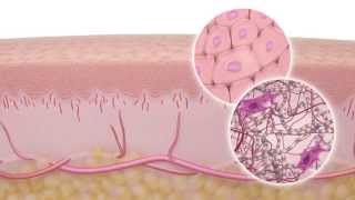 Skin Anatomy and Physiology how skin reacts to wounds [upl. by Mckee]