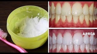 Le Bicarbonate de Soude Pour Des Dents Blanches en seulement 5 Minutes [upl. by Levey]