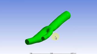 3D Bifurcating Artery steady  Create Named Selections [upl. by Sorenson995]