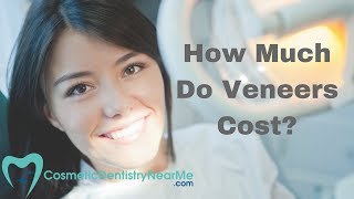 How much do veneers cost [upl. by Hephzipa]