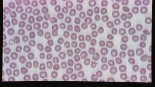 Blood Smear Evaluation [upl. by Elstan474]