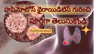 All about Hashimotos Thyroiditis in Telugu  How to cure  Diet Changes  Dr Harika Kuppala [upl. by Ytsirhk]