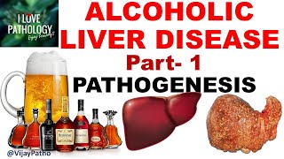 ALCOHOLIC LIVER DISEASE Part 1 Pathogenesis [upl. by Zsazsa988]