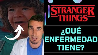 ¿Qué ENFERMEDAD padece DUSTIN de STRANGER THINGS  Disóstosis cleidocraneal  shorts [upl. by Rehotsirk]