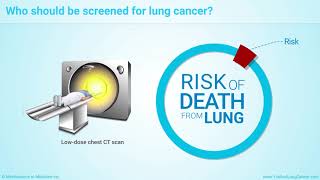 Diagnosis and Screening of Lung Cancer [upl. by Rentschler]