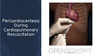 Pericardiocentesis During Cardiopulmonary Resuscitation by T Wolbrink  OPENPediatrics [upl. by Akeylah]