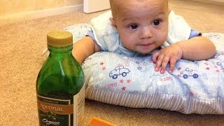 How to Get Rid of Cradle Cap [upl. by Etolas]