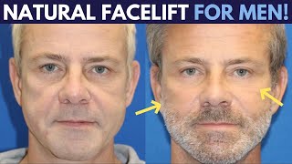 How the Male Facelift differs from Facelifts for women  Look as Natural as Possible [upl. by Hsirrap]