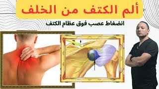 ألم الكتف من الخلف و انضغاط عصب فوق عظام الكتف suprascapular nerve compression [upl. by Saum87]