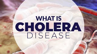 WHAT IS CHOLERA DISEASE [upl. by Corliss]