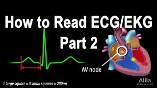 How to Read ECGEKG Part 2 Animation [upl. by Antonie132]