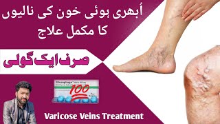 What is varicose veins Varicose veins treatment In urdu  ubhari hui naso ka ilaj [upl. by Pardew]