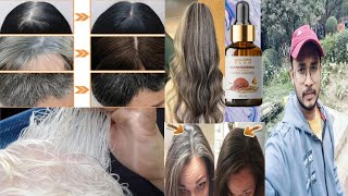 Ganoderma nutrient natural darkening  grey hair reverse  honest review [upl. by Gennaro]