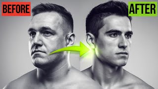 How to Get a Chiseled Jawline Fast with Simple Exercises [upl. by Htinnek]