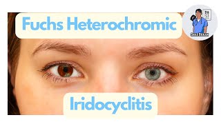 Fuchs Heterochromic Iridocyclitis FHC  What is this fascinating condition Eye Dr Explains 2023 [upl. by Boffa]