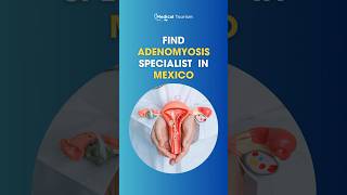 🔍 What is Adenomyosis 🔍Medical Tourism [upl. by Safire]