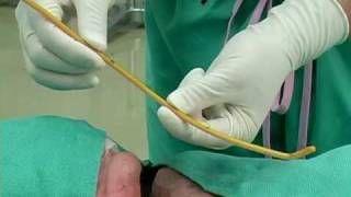 BougieAided Cricothyrotomy by Darren Braude [upl. by Dionysus]