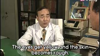 Oriental Medical Digest Ep019 Liver cancer [upl. by Bowie]