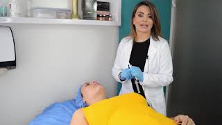 Perfilamiento de rostro con HIFU facial y Enzimas Recombinantes – Dra Adriana García [upl. by Caitrin]