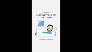 Supraventricular Tachycardia [upl. by Leemaj]