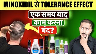 Minoxidil Not Working Anymore How to Beat the Tolerance Effect [upl. by Htiekal]