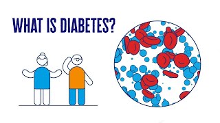 What Is Diabetes  2 Minute Guide  Diabetes UK [upl. by New]