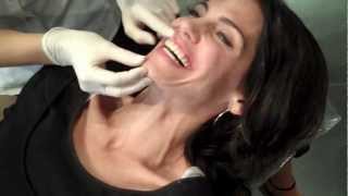 Mesa Orthodontics  Patient Getting Dental Braces Off [upl. by Adnat]