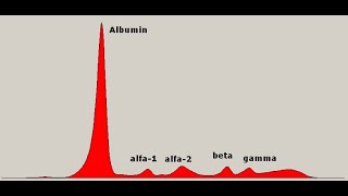 Práctica 3  Electroforesis de proteínas del suero [upl. by Asalocin]