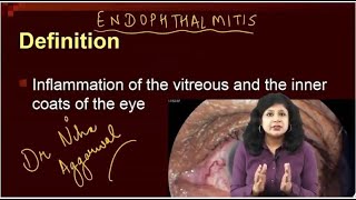 Endophthalmitis  Dr Niha Aggarwal [upl. by Rellek]