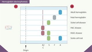 Hemoglobin electrophoresis [upl. by Anthia]