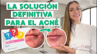 ISOTRETINOÍNA  ELIMINA EL ACNÉ  cómo eliminar el acné  dercutane  roaccutan  accutane [upl. by Nortal]