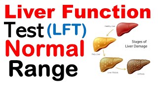 Liver function test normal range [upl. by Kehoe]