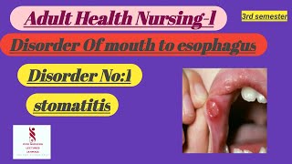 Stomatitis New slides AHN 3rd semester conceptual [upl. by Forbes]