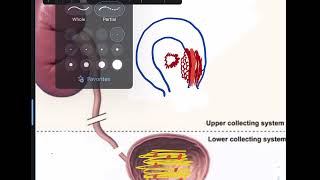 Nonneoplastic lesions of Urinary bladder [upl. by Iorio]